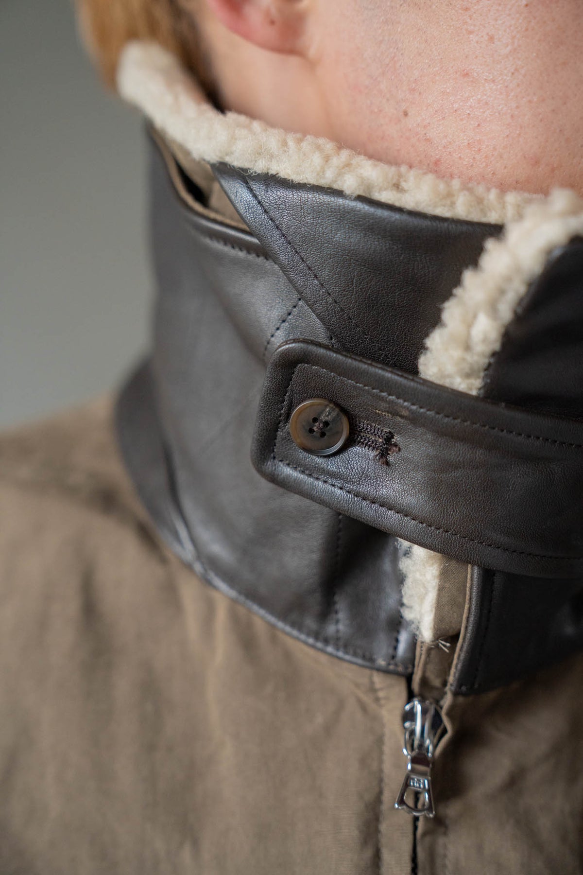 DETATCHABLE COLLAR RESIN-FINISH COTTON JACKET(ST.1576)