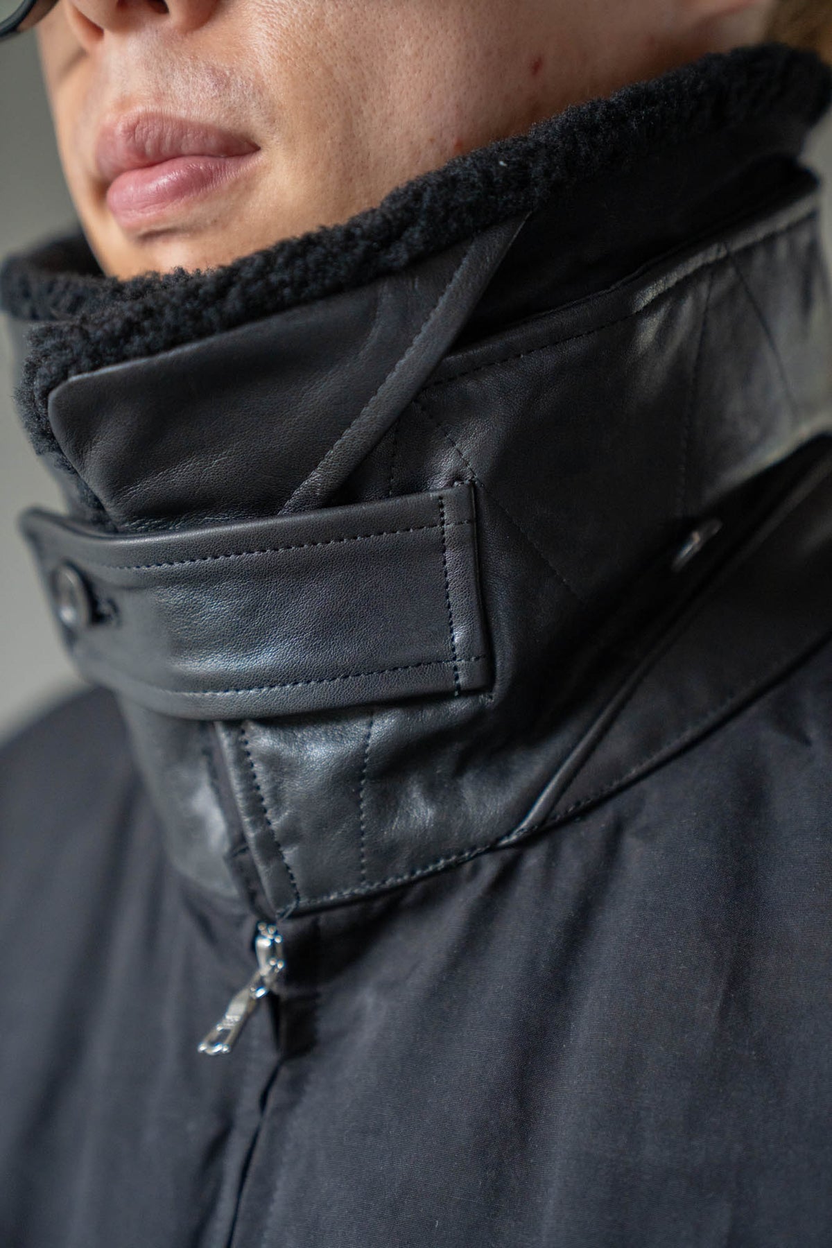 DETATCHABLE COLLAR RESIN-FINISH COTTON JACKET(ST.1576)